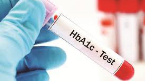 آزمایش هموگلوبین ای وان سی (HbA1C) چیست؟