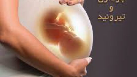 هیپوتیروئیدی در بارداری