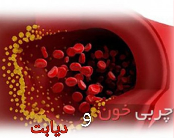 در مبتلایان به دیابت، اختلالات چربی خون بیشتر از افراد عادی دیده می‌شود. به همین دلیل به همه دیابتی‌ها توصیه می‌کنیم مراقب چربی خون خود باشند و مرتبا از این نظر توسط پزشک بررسی شوند.