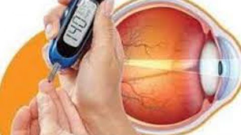 اختلالات بینایی بیماران دیابتی