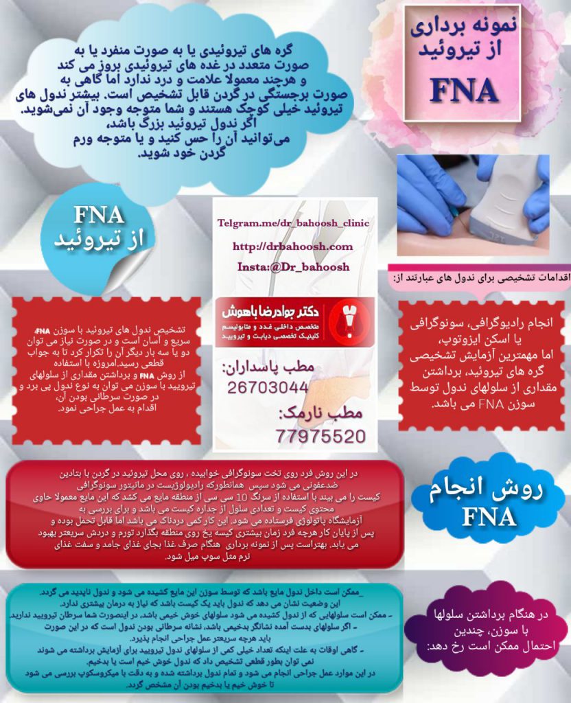 گره های تیروئیدی یا به صورت منفرد یا به صورت متعدد در غده های تیروئیدی بروز می کند و هرچند معمولا علامت و درد ندارد اما گاهی به صورت برجستگی در گردن قابل تشخیص است.