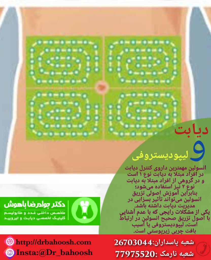 انسولین مهمترین داروی کنترل دیابت در افراد مبتلا بهدیابت نوع ۱ است و در گروهی از افراد مبتلا به دیابت نوع ۲ نیز استفاده می‌شود؛ بنابراین آموزش اصولی تزریق انسولین می‌تواند تأثیر بسزایی در مدیریت دیابت داشته باشد. یکی از مشکلات رایجی که با عدم آشنایی با اصول تزریق صحیح انسولین در ارتباط است، لیپودیستروفی یا آسیب بافت چربی زیرپوستی است.
