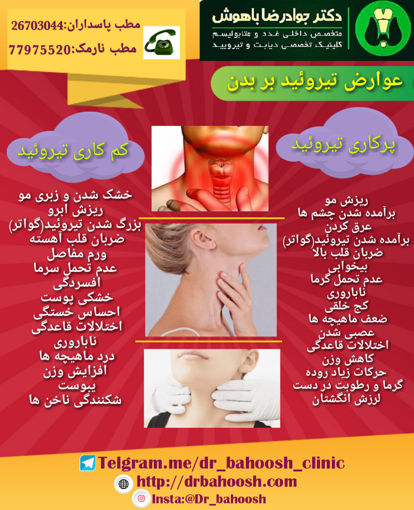 «‌فدراسیون جهانی تیروئید» ۴ لغایت ۱۰ خرداد ماه را به منظور افزایش سطح آگاهی مردم از بیماری‌های تیروئید، عوارض، راه‌های پیشگیری و درمان آن را به عنوان «هفته جهانی اطلاع‌رسانی تیروئید» معرفی کرده است.