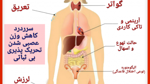 همه چیز در مورد بیماری گریوز