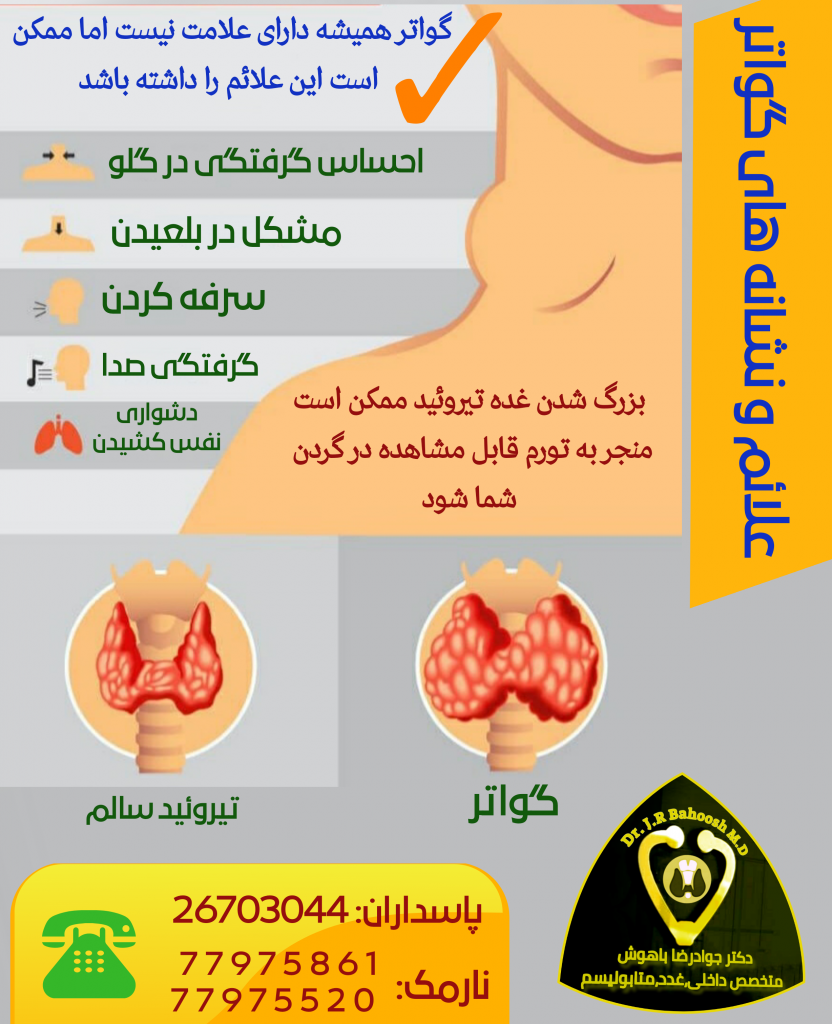 بزرگ شدن غده تیروئید  به نام گواتر شناخته می شود. رشد گواتر می تواند در هر کسی رخ دهد. اما نوعی از گواتر وجود دارد که تنها در افراد خاصی ایجاد می شود. مردان نسبت به زنان بیشتر به رشد گواتر مبتلا می شوند