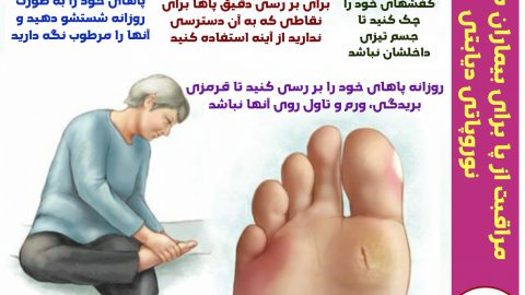 چه چیزی باعث نوروپاتی دیابتی می‌شود؟   